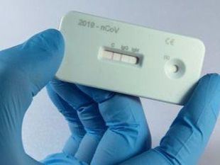 Luz verde a la venta de los test para el autodiagnóstico en farmacias