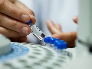 La Ayuda Merck de Investigación en Medicina Individualizada de Precisión premia un estudio sobre células tumorales circulantes