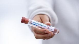 La variante Delta ya supone el 77% de los nuevos casos de coronavirus en España