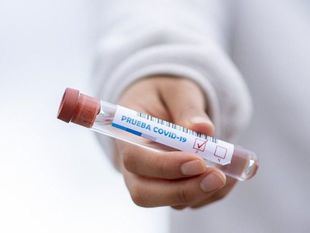 El ritmo de contagios sigue ralentizado y se reduce la presión hospitalaria por Covid