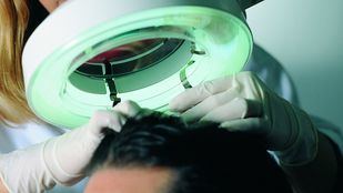 Svenson reabre su clínica del Barrio de Salamanca con dos nuevos quirófanos para implantes capilares