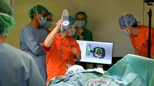 El Gregorio Marañón presenta un sistema pionero en el tratamiento de malformaciones craneofaciales en bebés