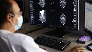 Cáncer: si se investigara más, en 20 años habría tratamiento para la mayor parte de los tumores