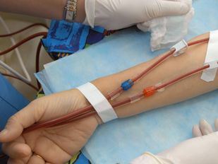 Los pacientes con diálisis domiciliaria reclaman que la huelga de transporte no les deje sin suministros