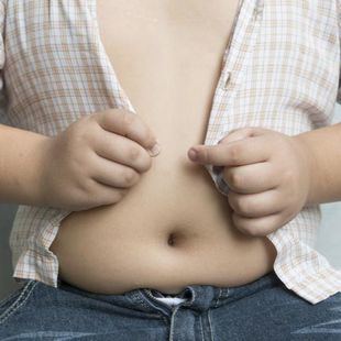 La obesidad infantil en España, "un asunto de Estado"