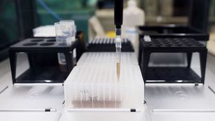 Los casos confirmados de viruela del mono en Madrid suben a 296