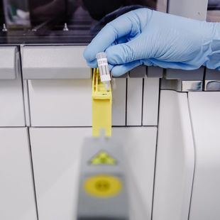 Madrid contabiliza 921 casos de viruela del mono