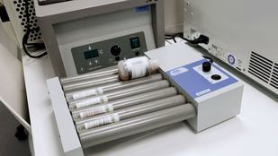 Madrid registra más de 1.000 casos de viruela del mono