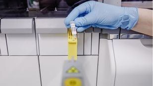 Madrid recibirá 1.835 dosis para la vacunación preexposición de la viruela del mono