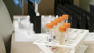 Los casos Covid registran una tendencia descendente, pero aumentan los de viruela