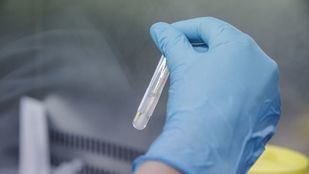 Suspendidas las citas para la vacuna contra la viruela del mono por falta de viales