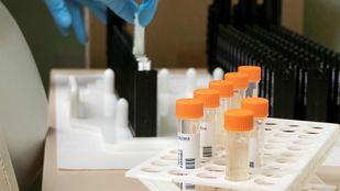 Madrid registra 2.493 casos de viruela del mono y suma 6.643 vacunados