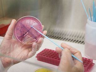 Madrid investiga ya 17 casos de hepatitis infantil aguda de origen desconocido