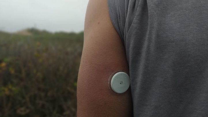 Paciente diabético con un sensor de glucosa