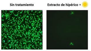 Científicos de la Autónoma encuentran un remedio contra el coronavirus catarral