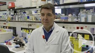 Identifican un gen clave en el desarrollo y tratamiento del cáncer de páncreas más común