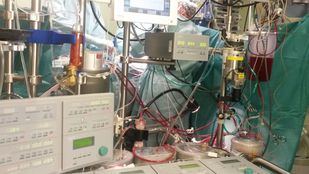 Récord en el Hospital Gregorio Marañón: más de 150 trasplantes en 2022