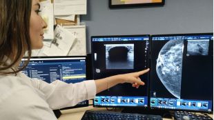 El Hospital público Severo Ochoa incorpora la crioablación en el tratamiento del cáncer de mama