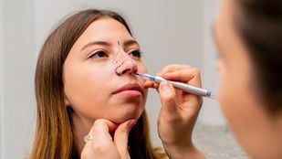 Rinoplastia y salud: ¿cómo afecta el aspecto al autoestima?