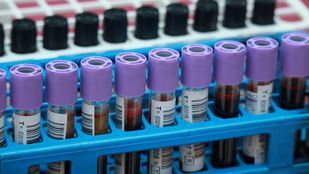 Campaña para garantizar las reservas de sangre en Navidad con chocolate y churros para los donantes