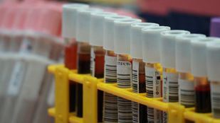 Se necesitan donaciones urgentes de sangre A+ y B-, ambas en alerta roja