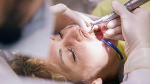 Cuidados postoperatorios para implantes dentales