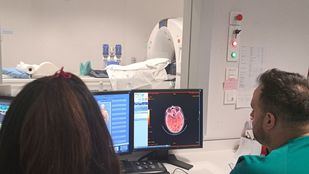 El 12 de Octubre inicia un ensayo clínico para meningiomas recurrentes sin tratamiento efectivo