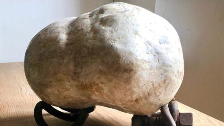 Óxidos de Pilar Recuenco