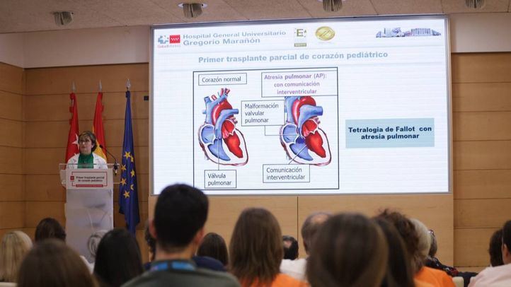 Este trasplante abre una nueva vía terapéutica para niños con cardiopatías congénitas graves.