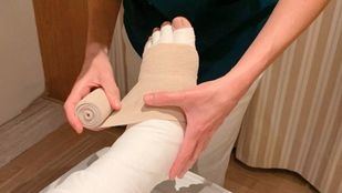 Terapia de un fisioterapeuta para el linfedema