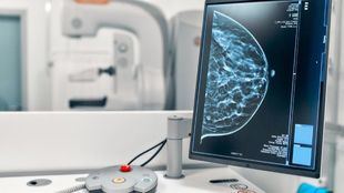 Sanidad extiende el programa de detección de cáncer de mama entre los 45 y los 74 años