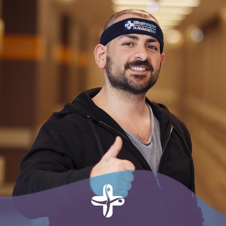 ¿Qué es el FUE? Todo sobre el método más eficaz de injerto de pelo