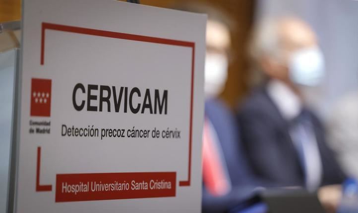 Presentación del programa Cervicam
