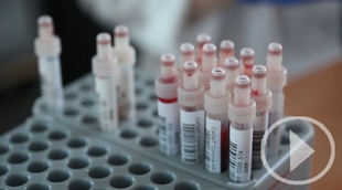 El Covid-19 rebasa los 21 millones de contagios a nivel mundial