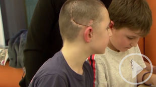 Félix, el niño de 10 años con un cráneo impreso en 3D