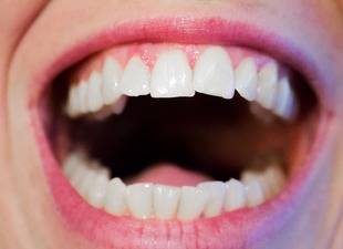 ¿Es útil utilizar un irrigador dental?