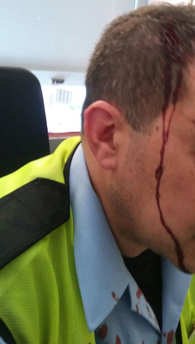 Imagen del vigilante agredido en Delicias. (Foto: CCOO)