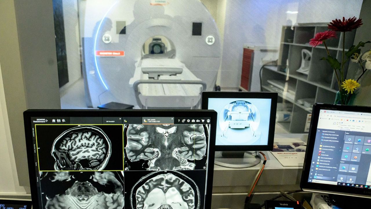 Magneton Cima.X (Foto: Siemens Healthineers España)