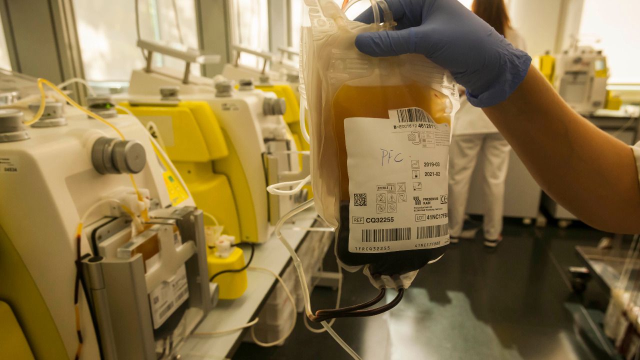 Plasma (Foto: Chema Barroso)