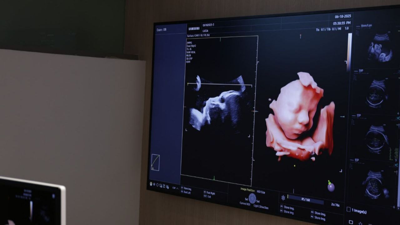 Una de las imágenes de una ecografía de embarazo