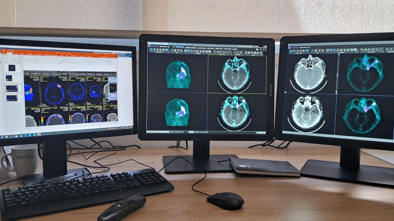 Imágenes de alta precisión (Foto: Hosptal 12 de Octubre)