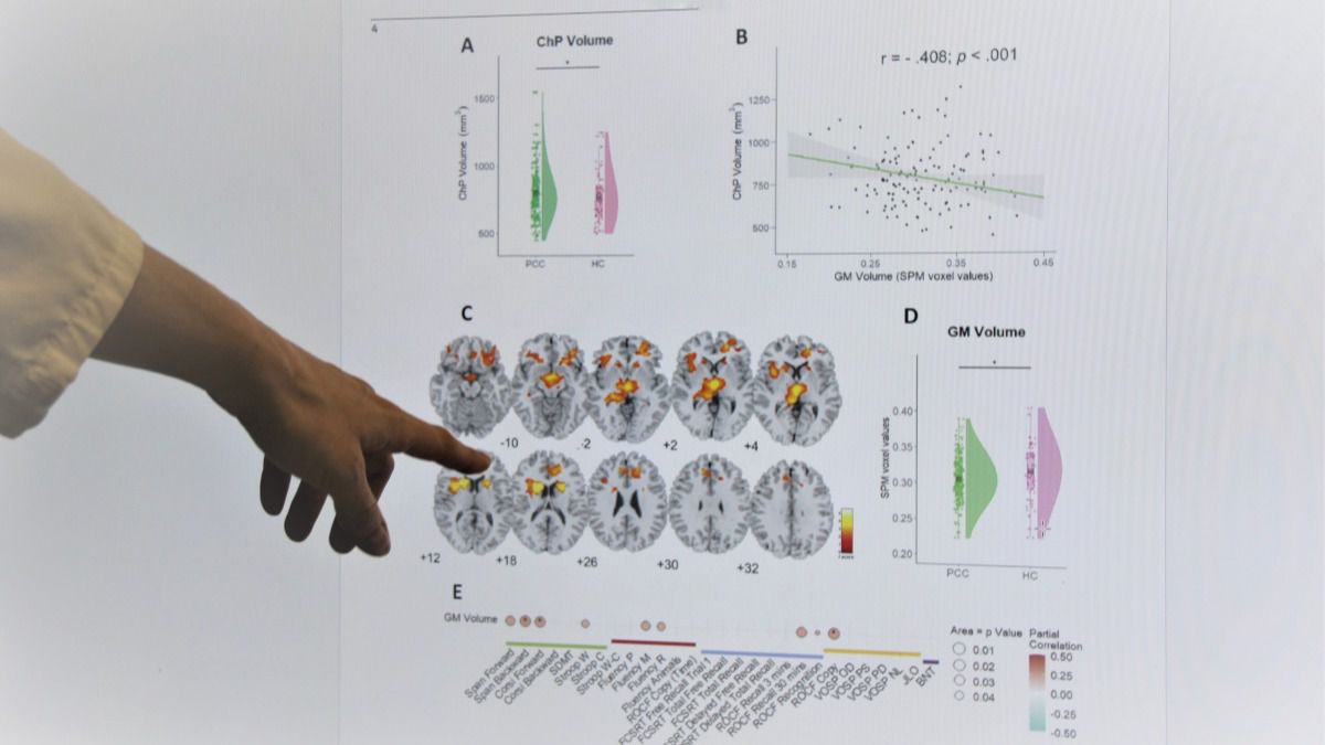 Estudio del neurólogo del Hospital Clínico San Carlos, Jordi Matías-Guiu 